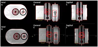 Quality assurance of an established online adaptive radiotherapy program: patch and software upgrade